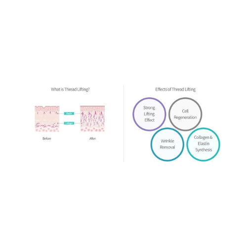 Neogenesis PDO COMBI COG Thread 23G, 60mm