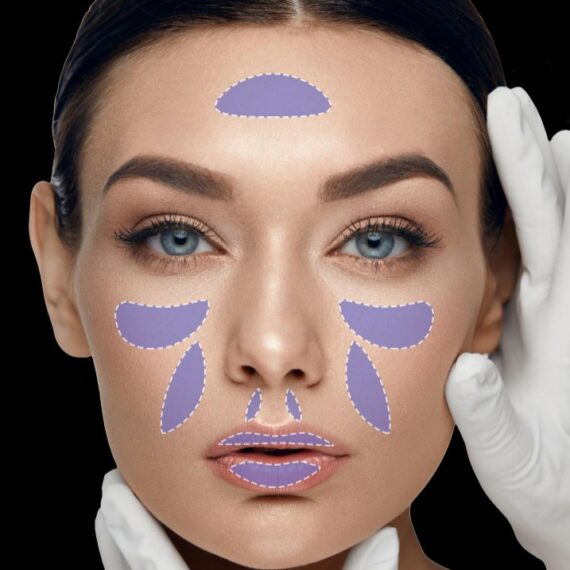 Youthfill Deep - Dermal Filler